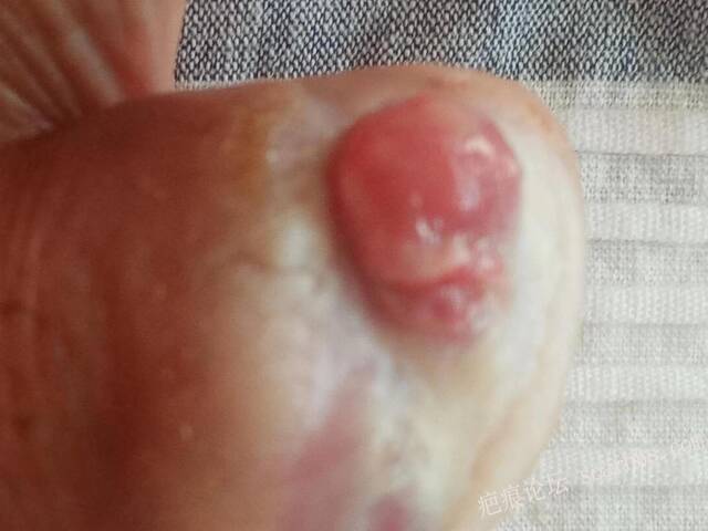 李高令面对（志愿者）有时显的自己很无奈…（青岛） 