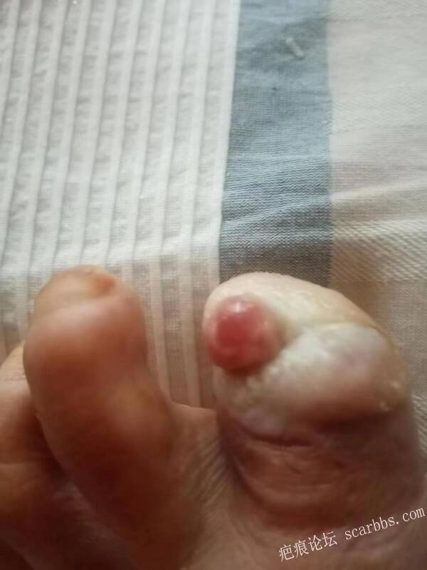 李高令面对（志愿者）有时显的自己很无奈…（青岛） 