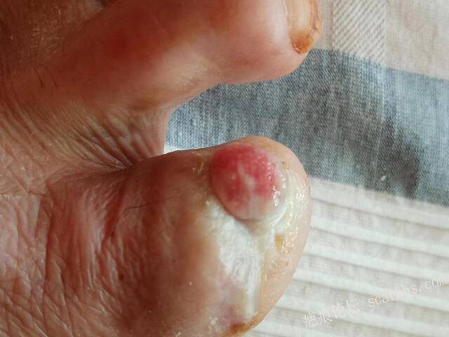 李高令面对（志愿者）有时显的自己很无奈…（青岛） 