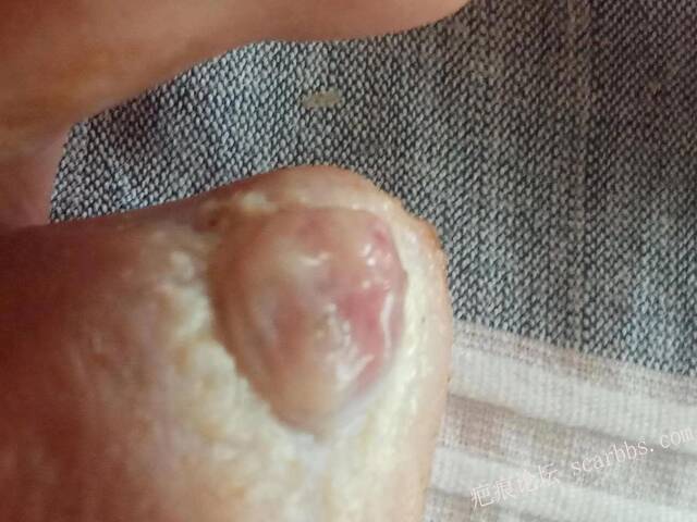 李高令面对（志愿者）有时显的自己很无奈…（青岛） 