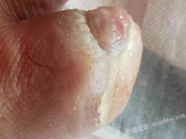 李高令面对（志愿者）有时显的自己很无奈…（青岛） 