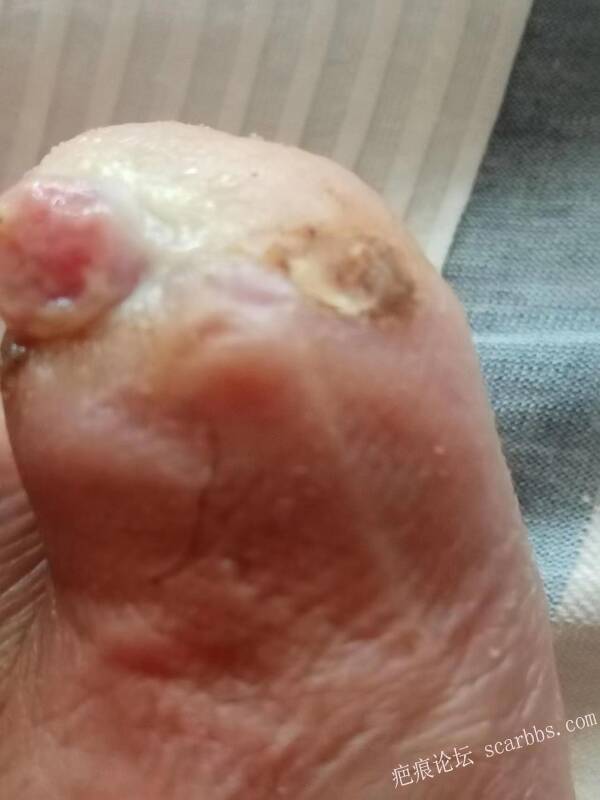 李高令面对（志愿者）有时显的自己很无奈…（青岛） 