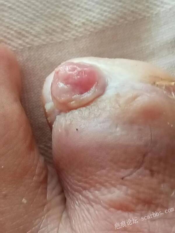 李高令面对（志愿者）有时显的自己很无奈…（青岛） 