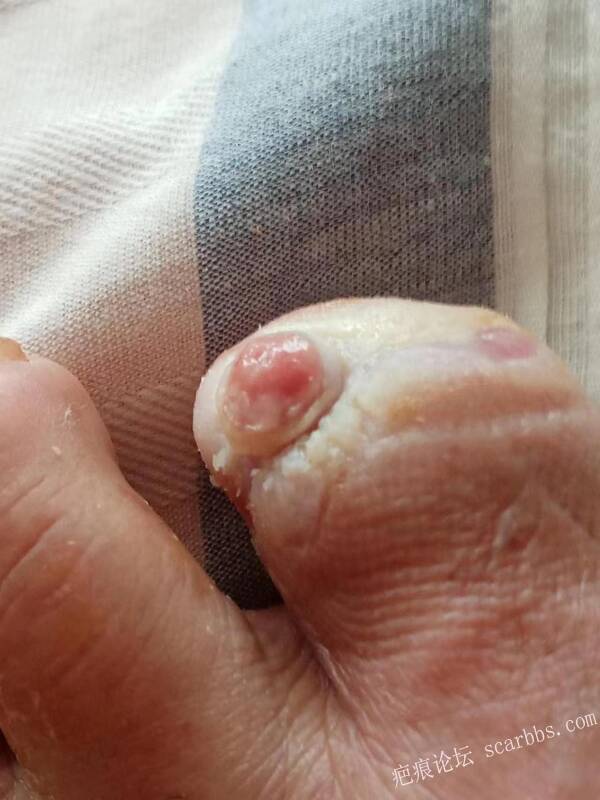 李高令面对（志愿者）有时显的自己很无奈…（青岛） 