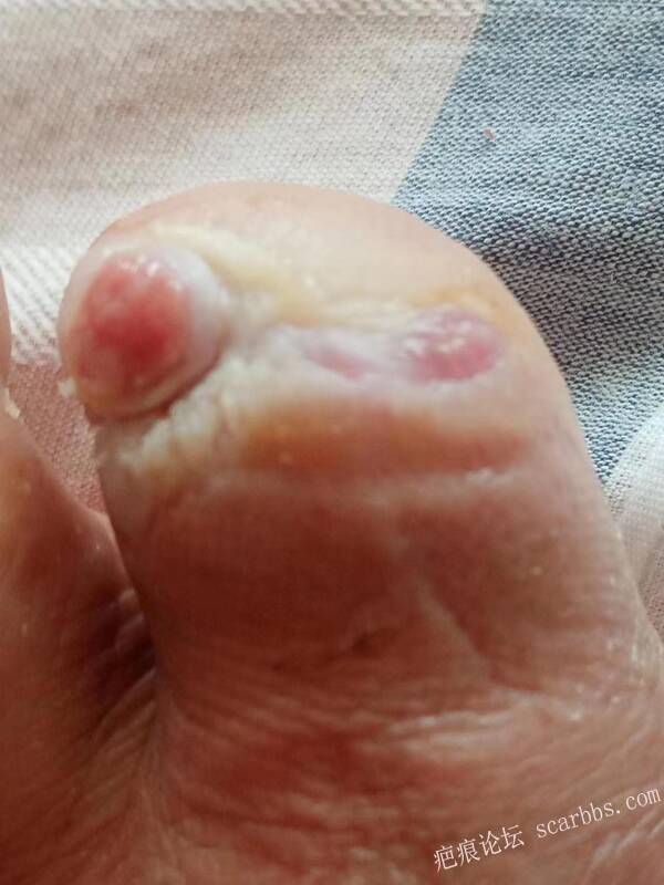 李高令面对（志愿者）有时显的自己很无奈…（青岛） 