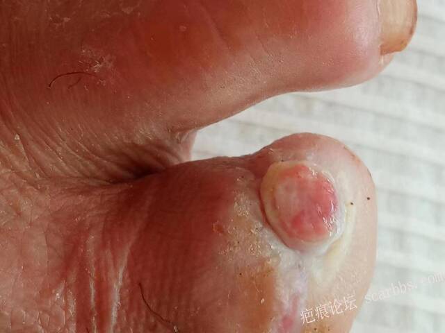 李高令面对（志愿者）有时显的自己很无奈…（青岛） 