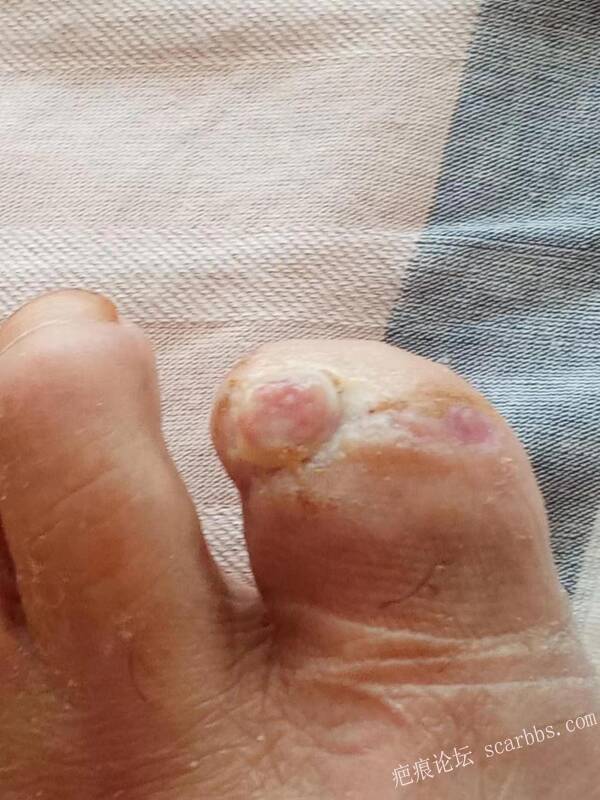 李高令面对（志愿者）有时显的自己很无奈…（青岛） 