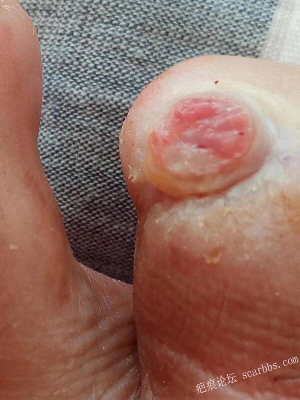 李高令面对（志愿者）有时显的自己很无奈…（青岛） 