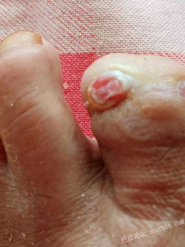 李高令面对（志愿者）有时显的自己很无奈…（青岛） 