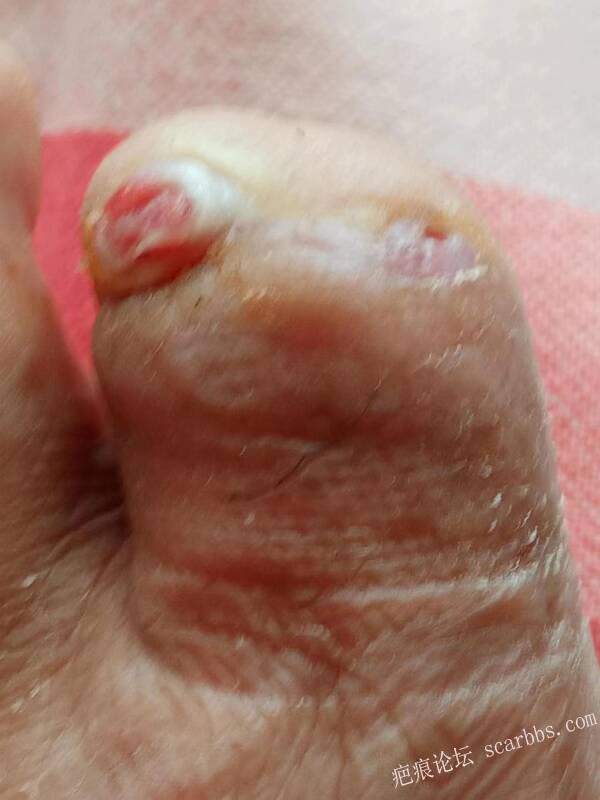 李高令面对（志愿者）有时显的自己很无奈…（青岛） 