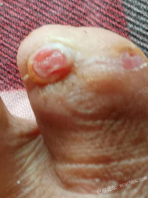 李高令面对（志愿者）有时显的自己很无奈…（青岛） 