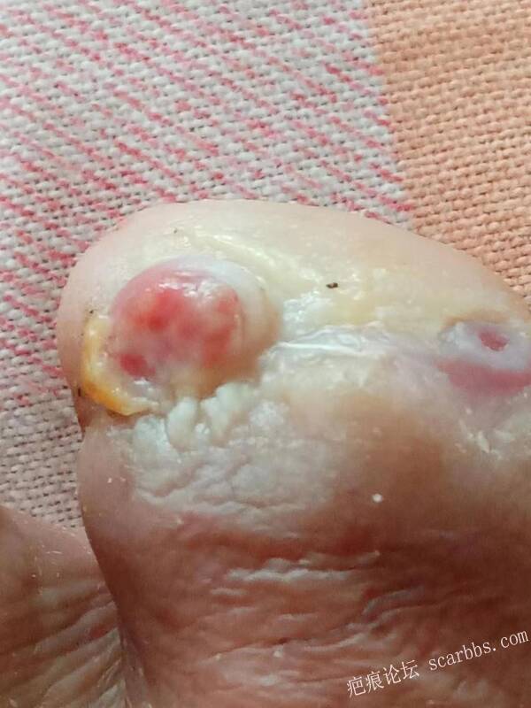 李高令面对（志愿者）有时显的自己很无奈…（青岛） 