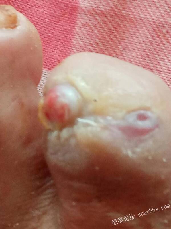 李高令面对（志愿者）有时显的自己很无奈…（青岛） 