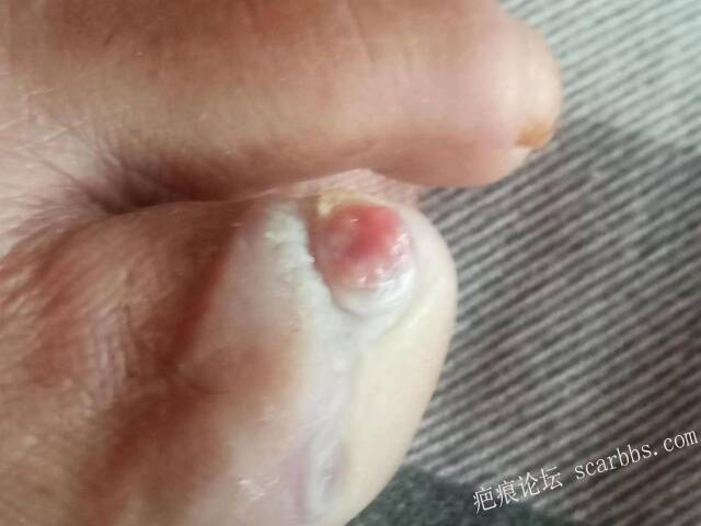 李高令面对（志愿者）有时显的自己很无奈…（青岛） 