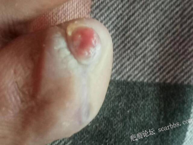 李高令面对（志愿者）有时显的自己很无奈…（青岛） 