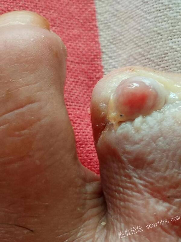 李高令面对（志愿者）有时显的自己很无奈…（青岛） 