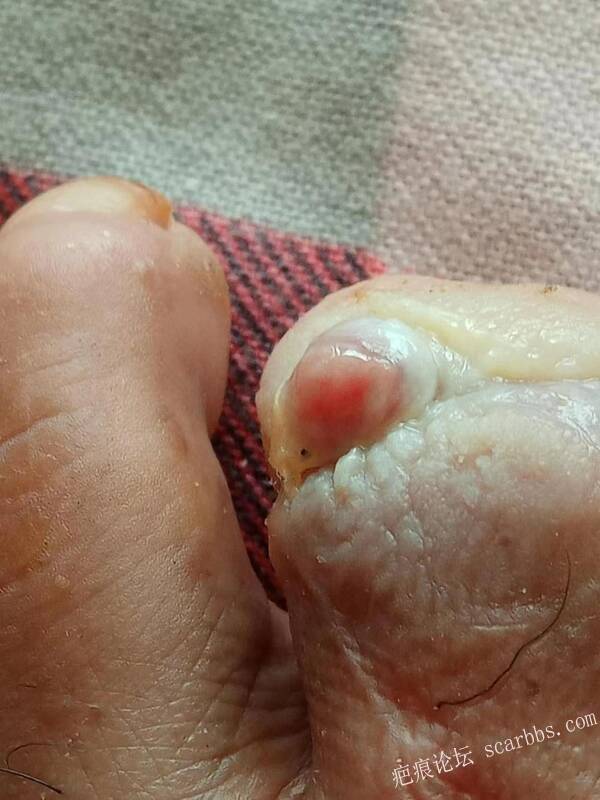 李高令面对（志愿者）有时显的自己很无奈…（青岛） 