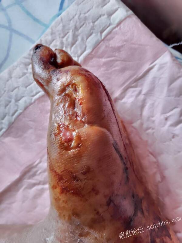 李高令2025年这次可能是我真的遇到了挑战 