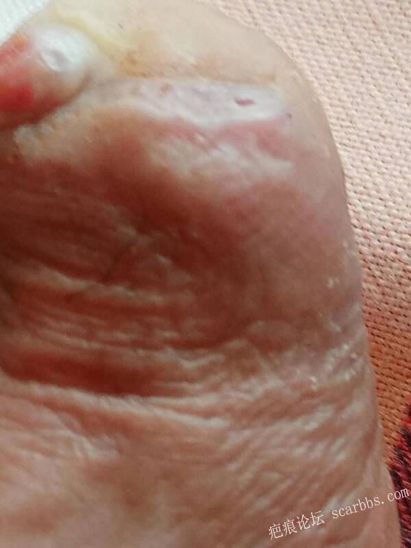 李高令面对（志愿者）有时显的自己很无奈…（青岛） 