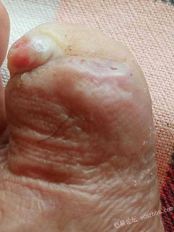 李高令面对（志愿者）有时显的自己很无奈…（青岛） 