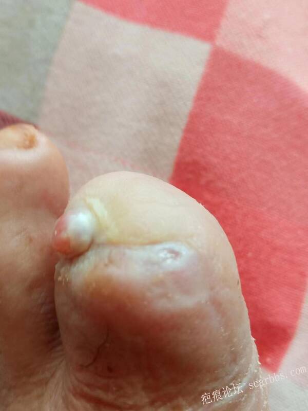 李高令面对（志愿者）有时显的自己很无奈…（青岛） 