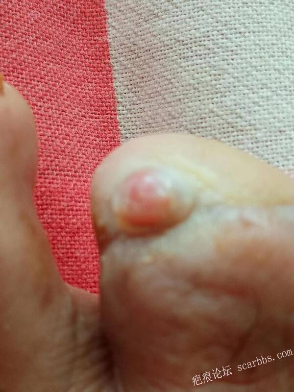 李高令面对（志愿者）有时显的自己很无奈…（青岛） 