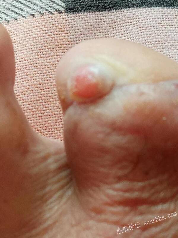 李高令面对（志愿者）有时显的自己很无奈…（青岛） 