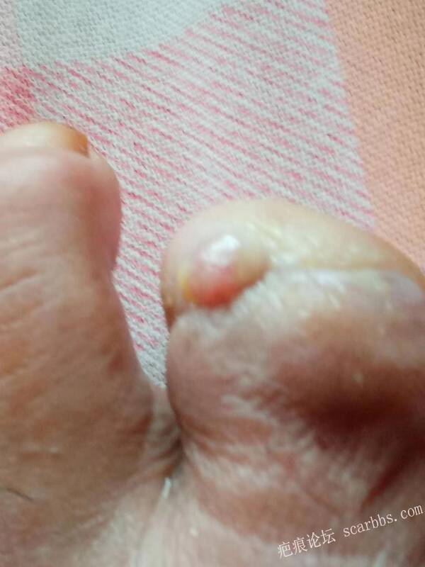 李高令面对（志愿者）有时显的自己很无奈…（青岛） 