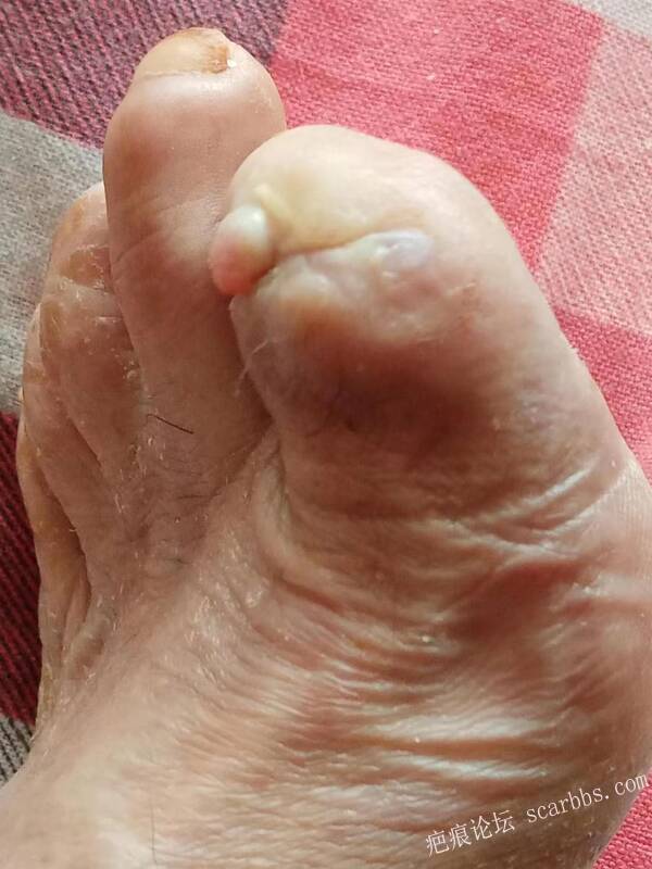 李高令面对（志愿者）有时显的自己很无奈…（青岛） 