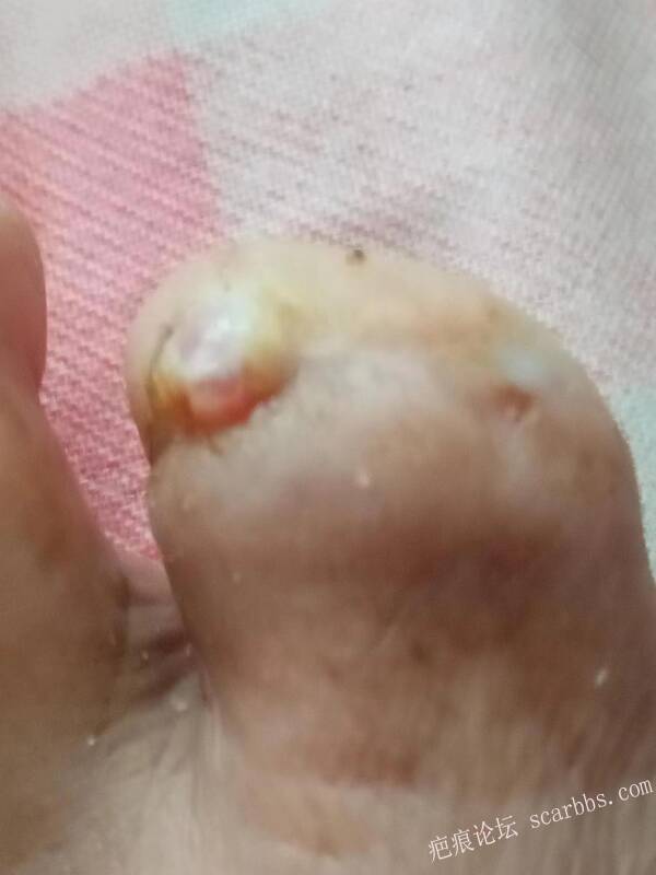 李高令面对（志愿者）有时显的自己很无奈…（青岛） 