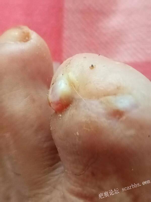 李高令面对（志愿者）有时显的自己很无奈…（青岛） 