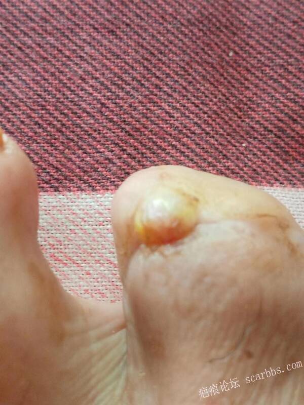 李高令面对（志愿者）有时显的自己很无奈…（青岛） 