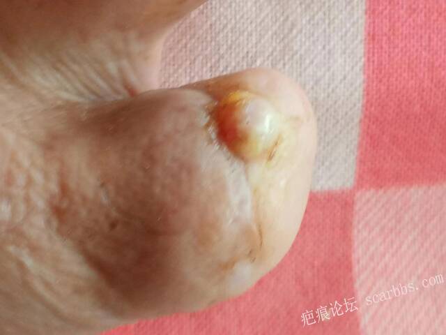 李高令面对（志愿者）有时显的自己很无奈…（青岛） 