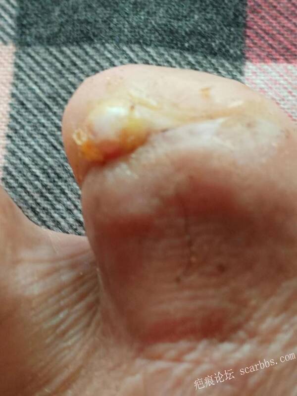 李高令面对（志愿者）有时显的自己很无奈…（青岛） 