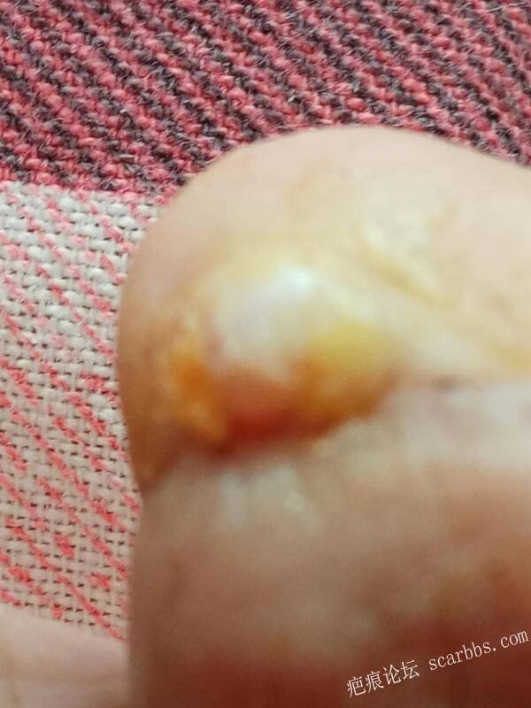 李高令面对（志愿者）有时显的自己很无奈…（青岛） 