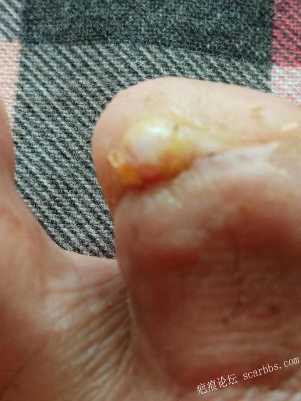 李高令面对（志愿者）有时显的自己很无奈…（青岛） 