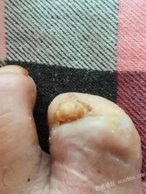 李高令面对（志愿者）有时显的自己很无奈…（青岛） 