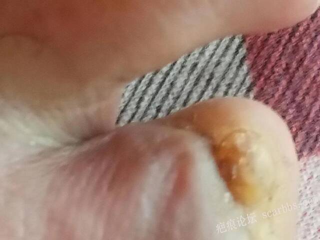 李高令面对（志愿者）有时显的自己很无奈…（青岛） 