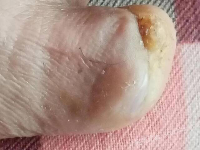 李高令面对（志愿者）有时显的自己很无奈…（青岛） 