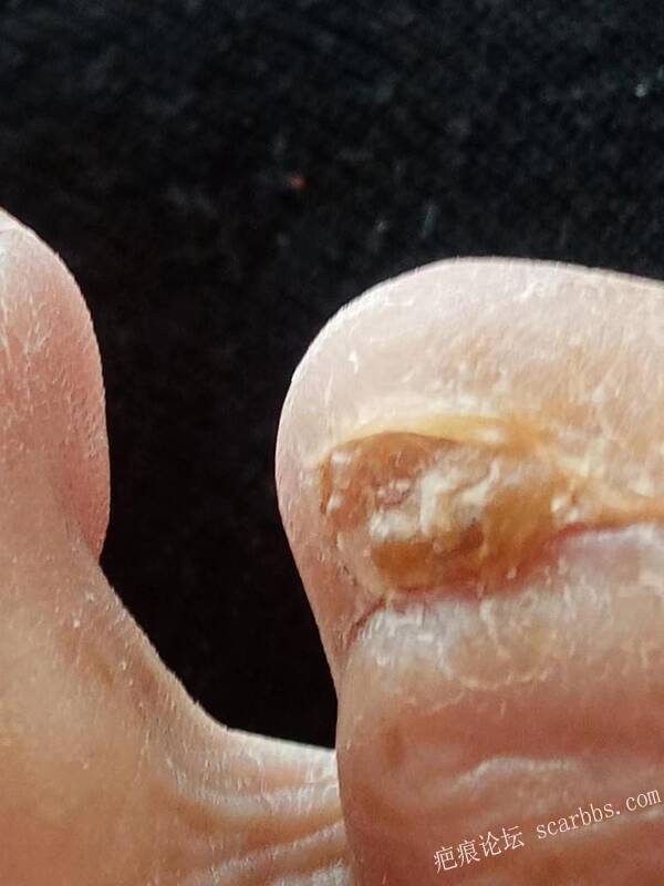 李高令面对（志愿者）有时显的自己很无奈…（青岛） 