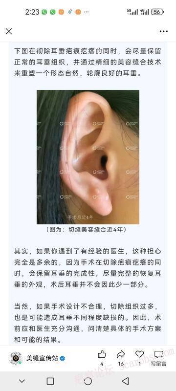 疤痕疙瘩