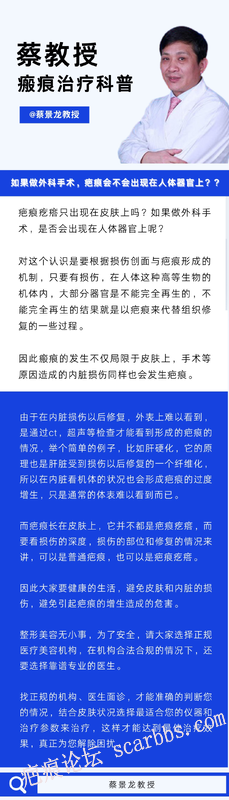 疤痕疙瘩只出现在皮肤上吗？如果做了外科手术，是否会出现在人体器官上呢？
