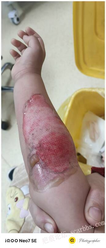 李高令只能流着泪说(信；是孩子的福气…)不信我真的很无奈…(泰安) 