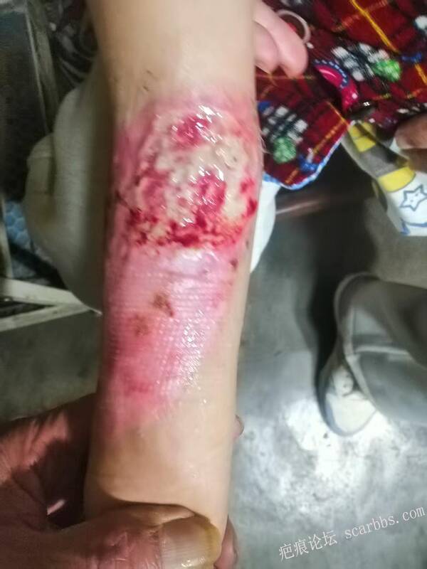 李高令只能流着泪说(信；是孩子的福气…)不信我真的很无奈…(泰安) 