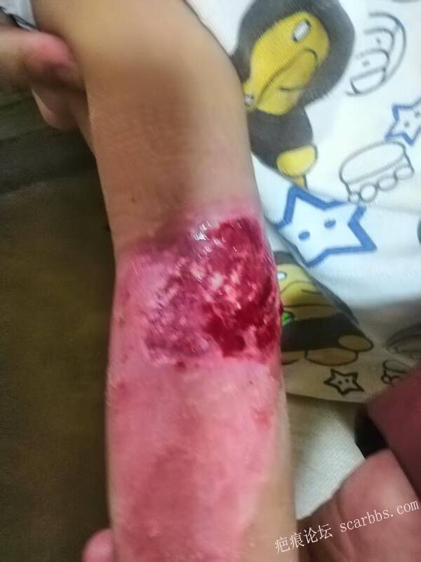 李高令只能流着泪说(信；是孩子的福气…)不信我真的很无奈…(泰安) 