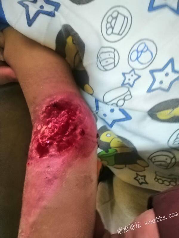 李高令只能流着泪说(信；是孩子的福气…)不信我真的很无奈…(泰安) 