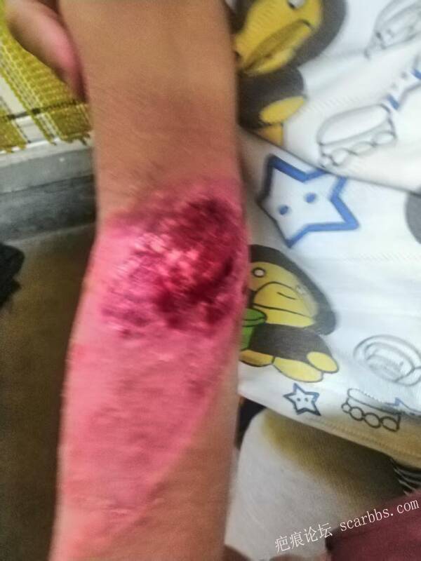 李高令只能流着泪说(信；是孩子的福气…)不信我真的很无奈…(泰安) 