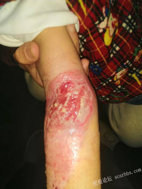 李高令只能流着泪说(信；是孩子的福气…)不信我真的很无奈…(泰安) 