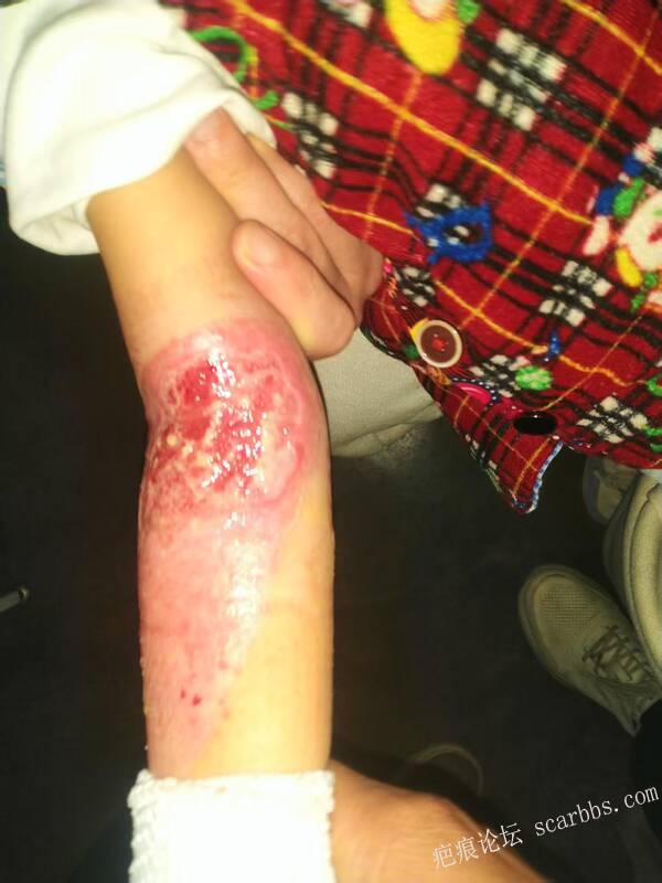 李高令只能流着泪说(信；是孩子的福气…)不信我真的很无奈…(泰安) 