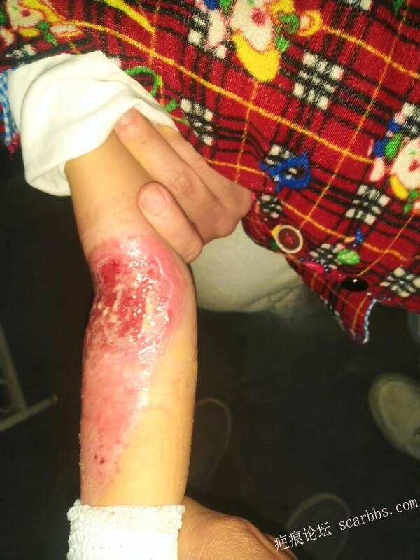 李高令只能流着泪说(信；是孩子的福气…)不信我真的很无奈…(泰安) 